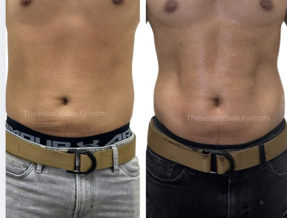 Before and after client result 5