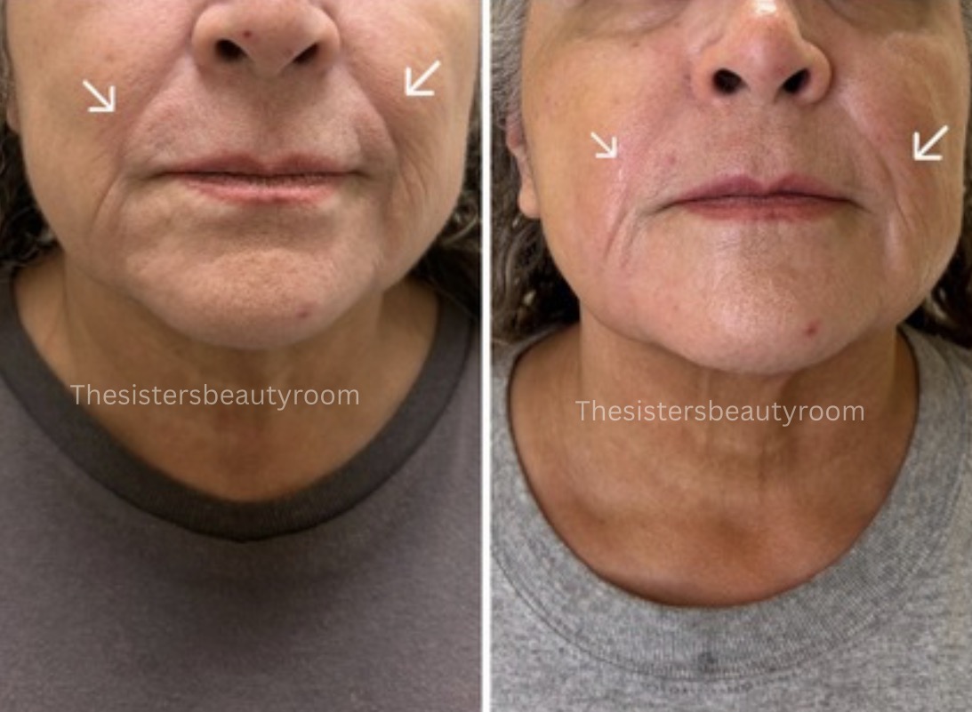 Before and after client result 7