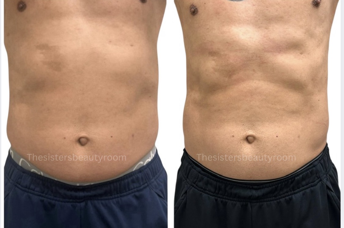 Before and after client result 10