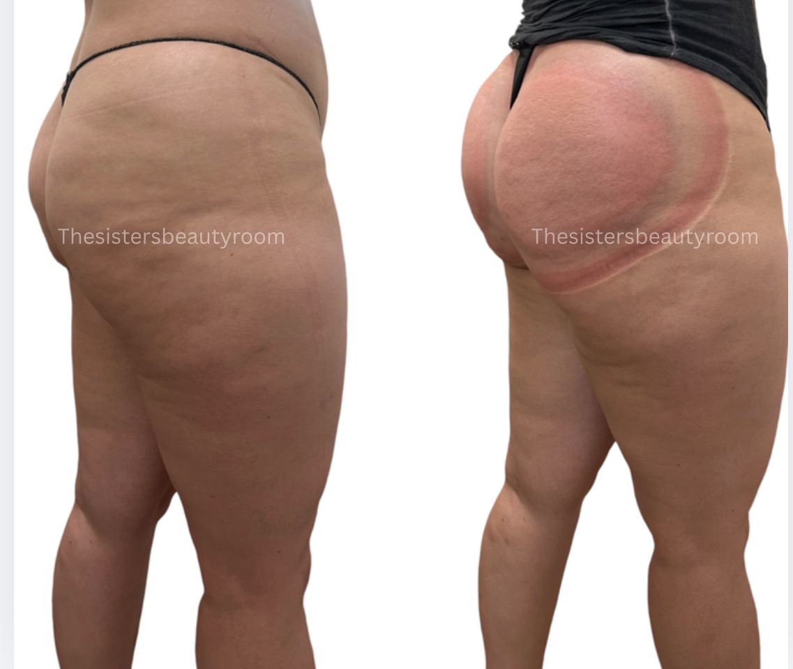 Before and after client result 11