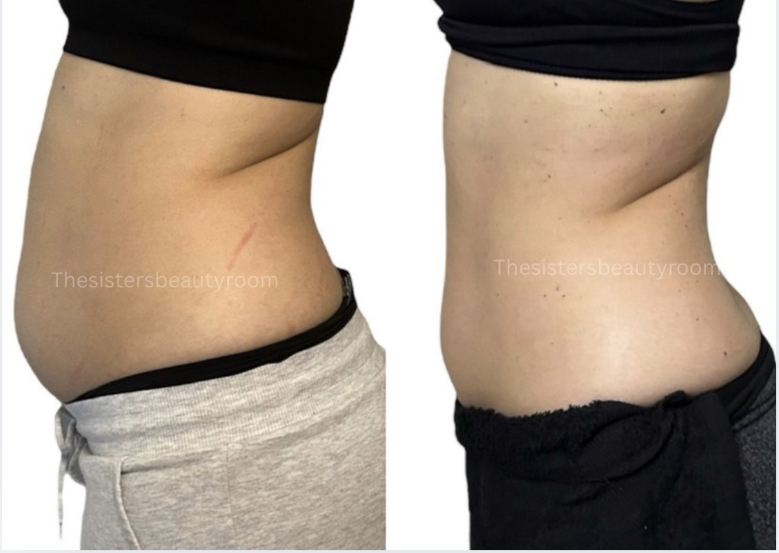 Before and after client result 12