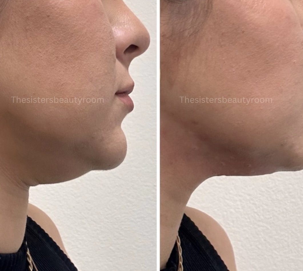 Before and after client result 6