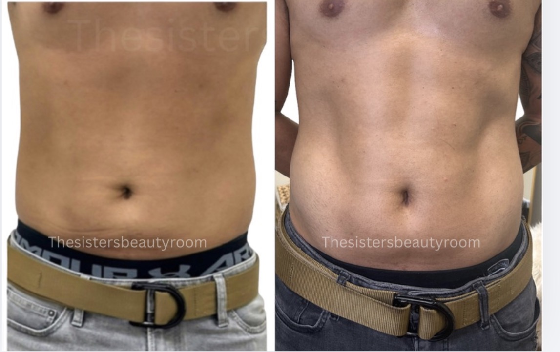 Before and after client result 8