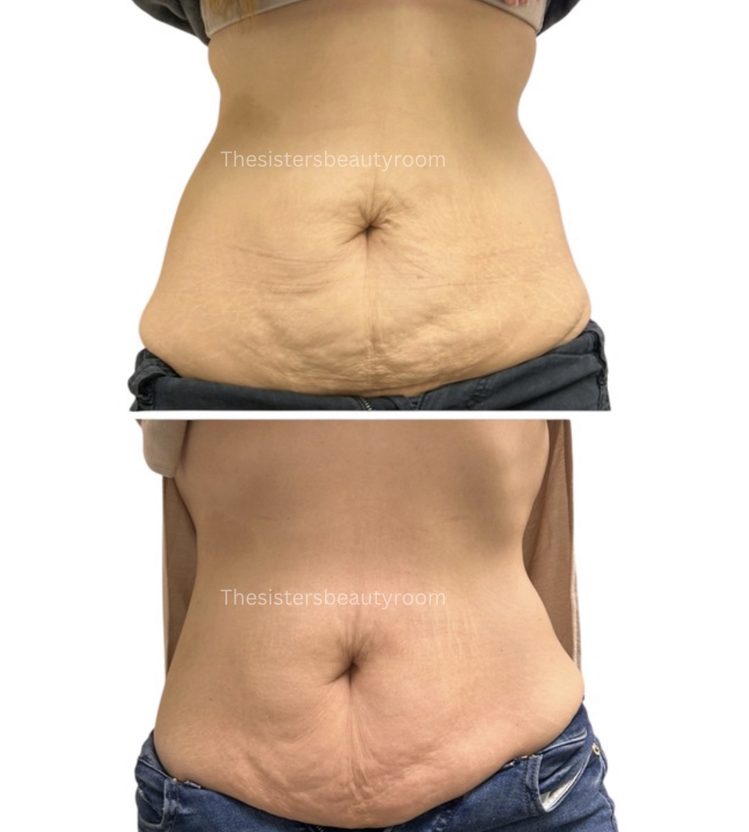 Before and after client result 9