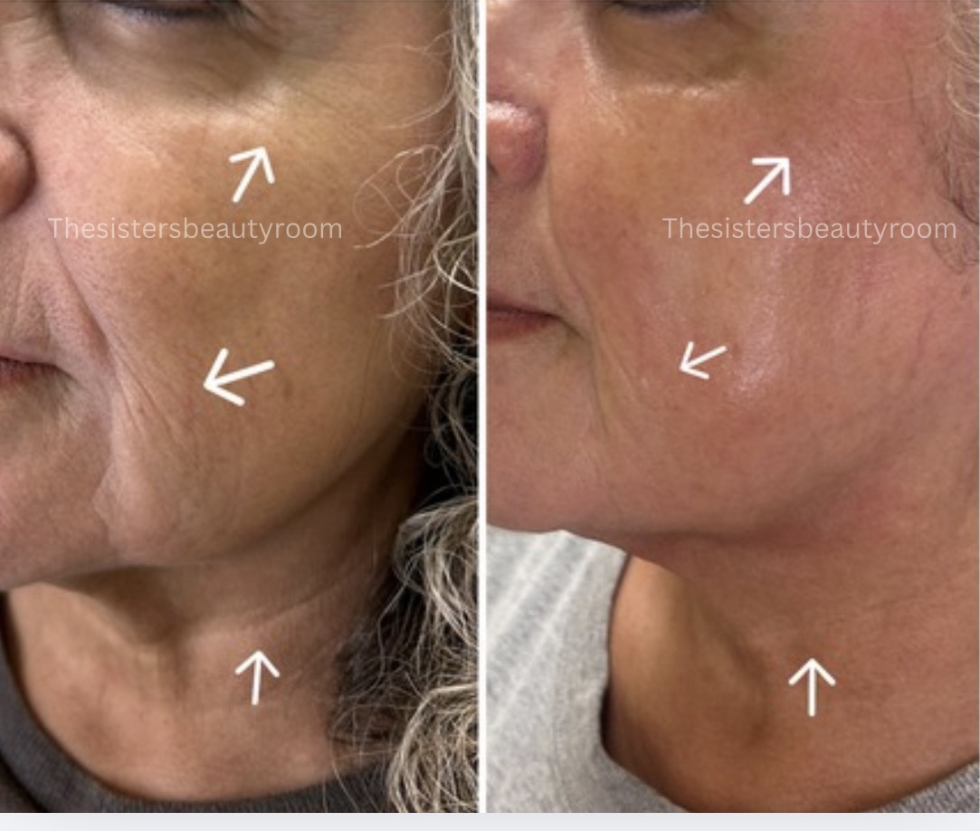 Before and after client result 3