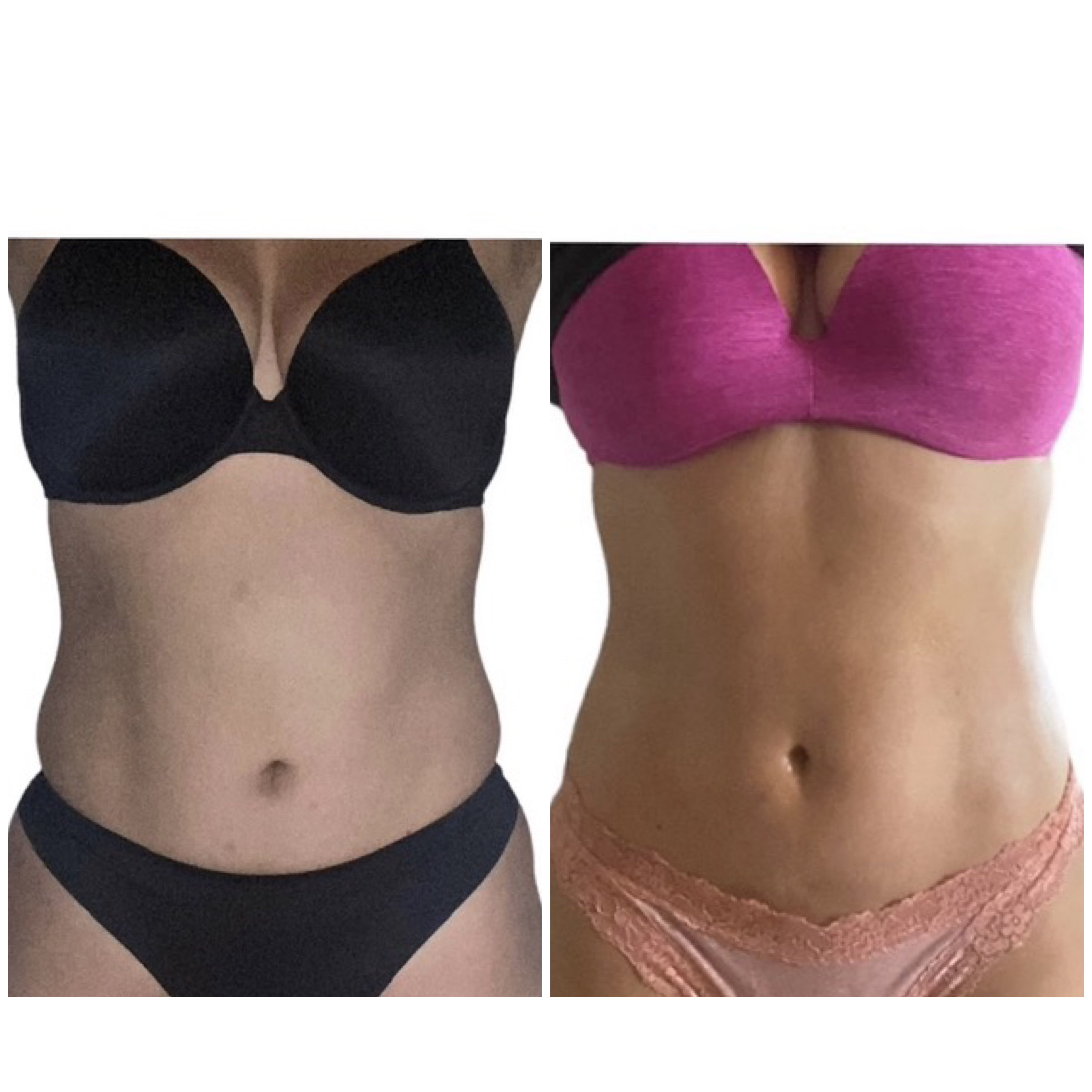 Before and after client result 1
